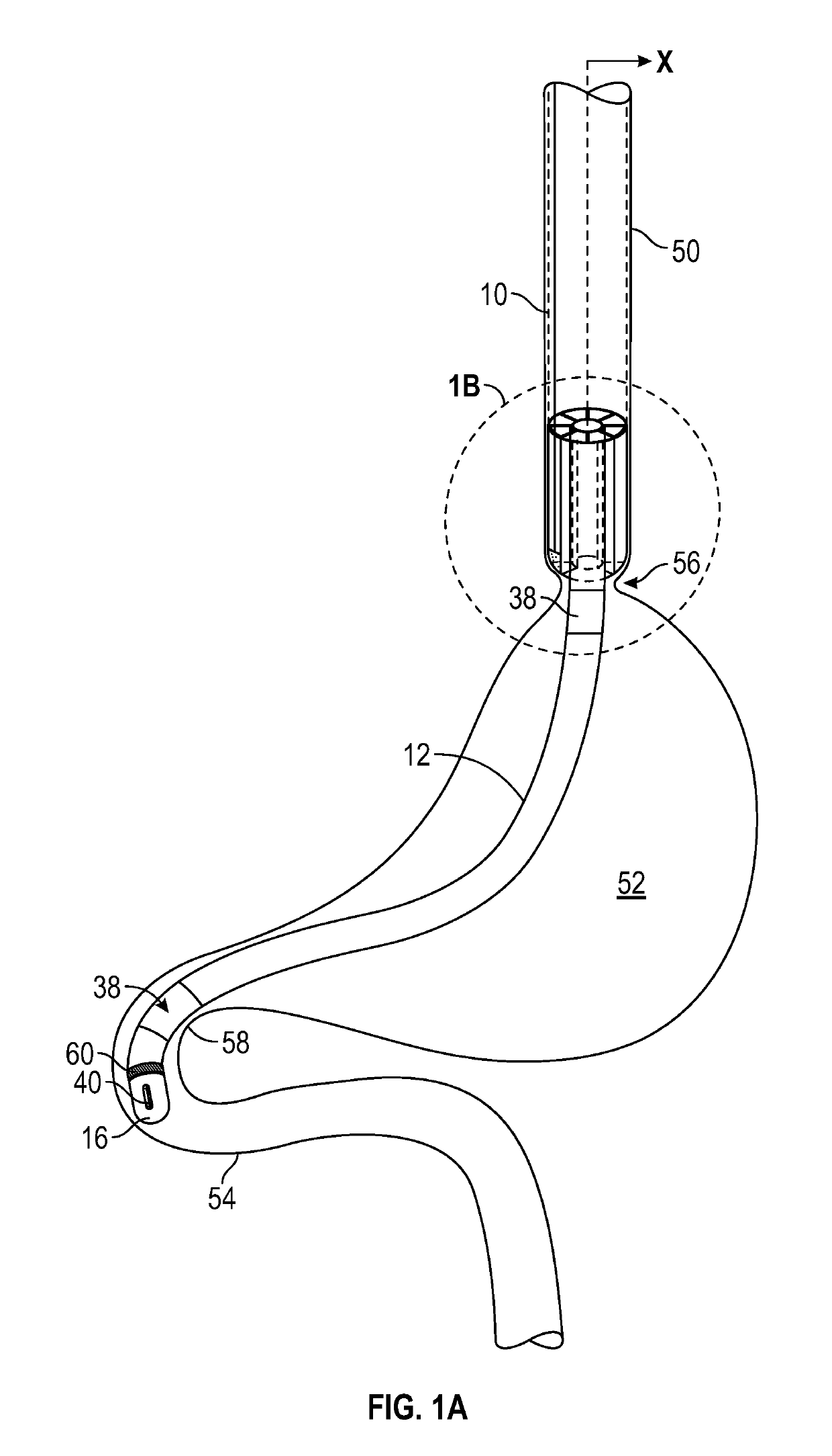 Enteral drug delivery system