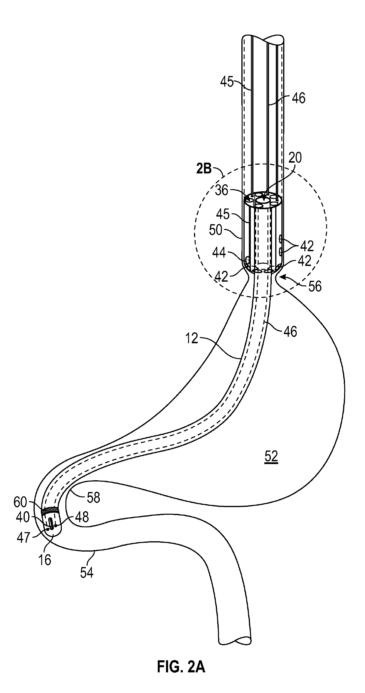 Enteral drug delivery system