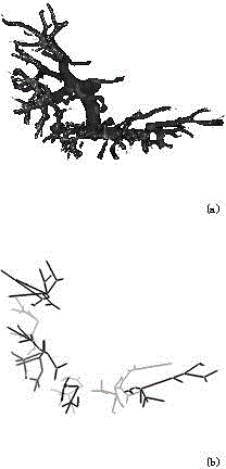 Liver Image Segmentation Method Based on Hierarchical Vascular Tree Division