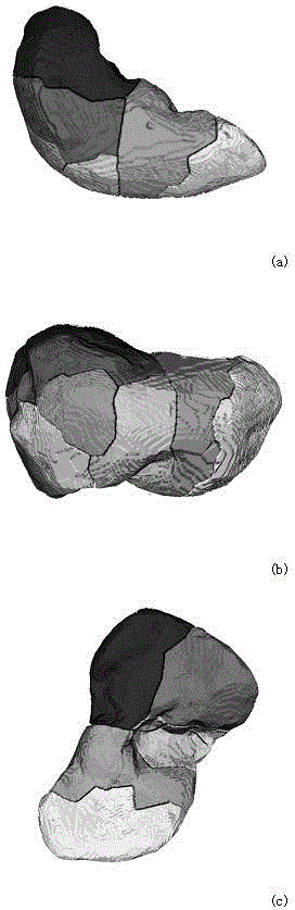 Liver Image Segmentation Method Based on Hierarchical Vascular Tree Division