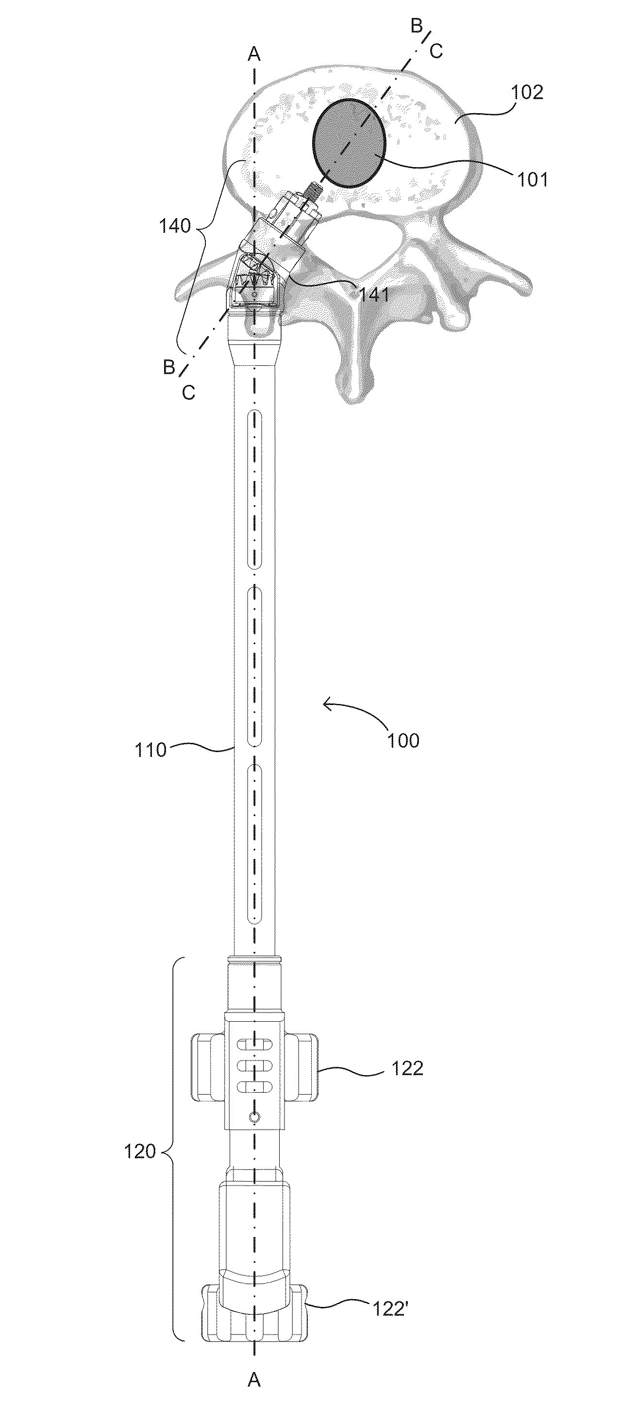 Implant insertion tool