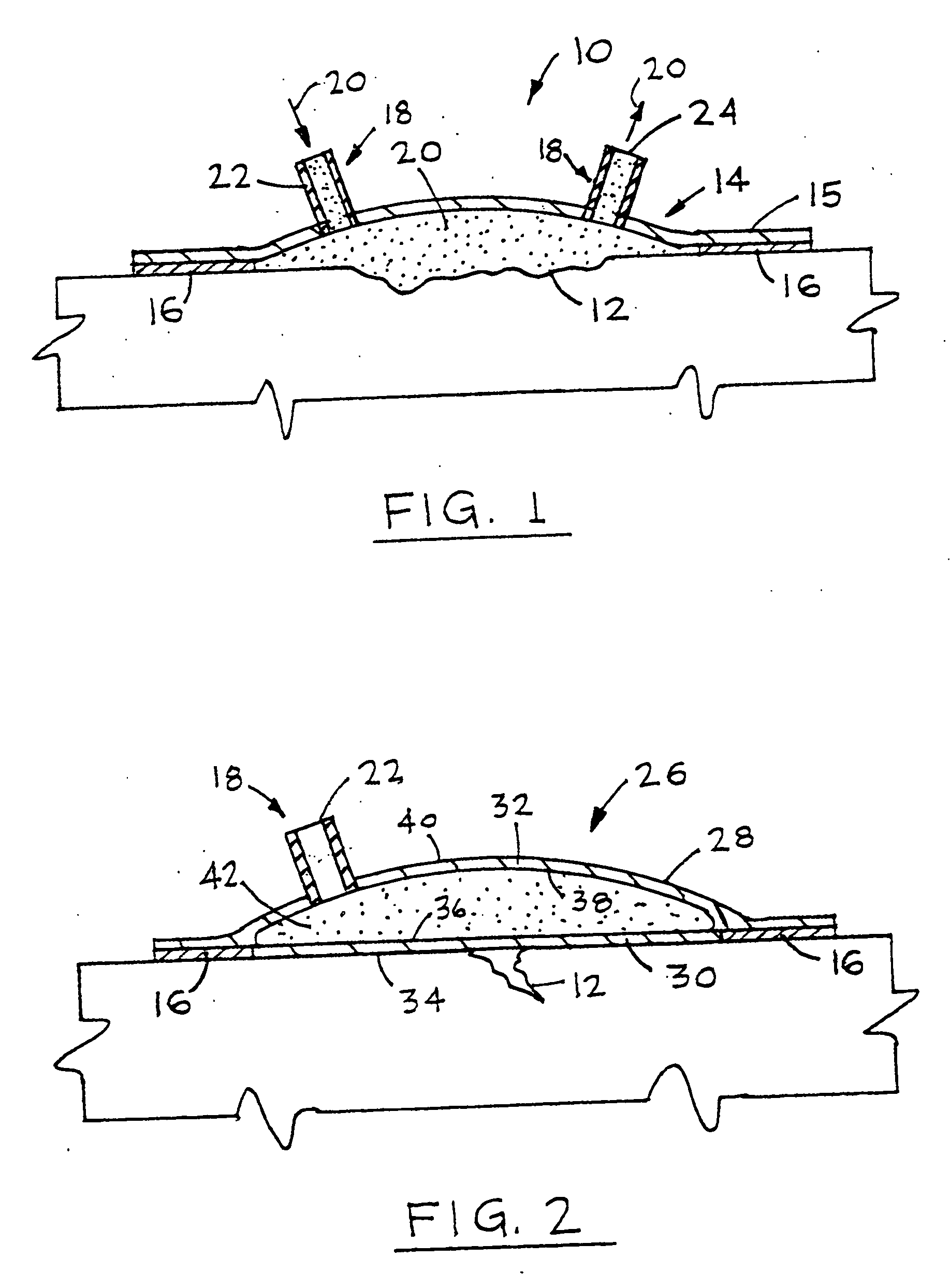 Device for treating and promoting healing of damaged body tissue