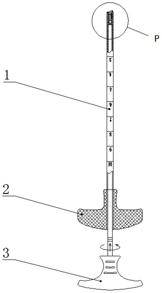 Implant for preventing bone cement leakage, preparation method and application, complete set of products for preventing bone cement leakage and using method