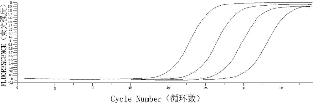 Kit for detecting mRNA expression quantity of M BCR fusion gene