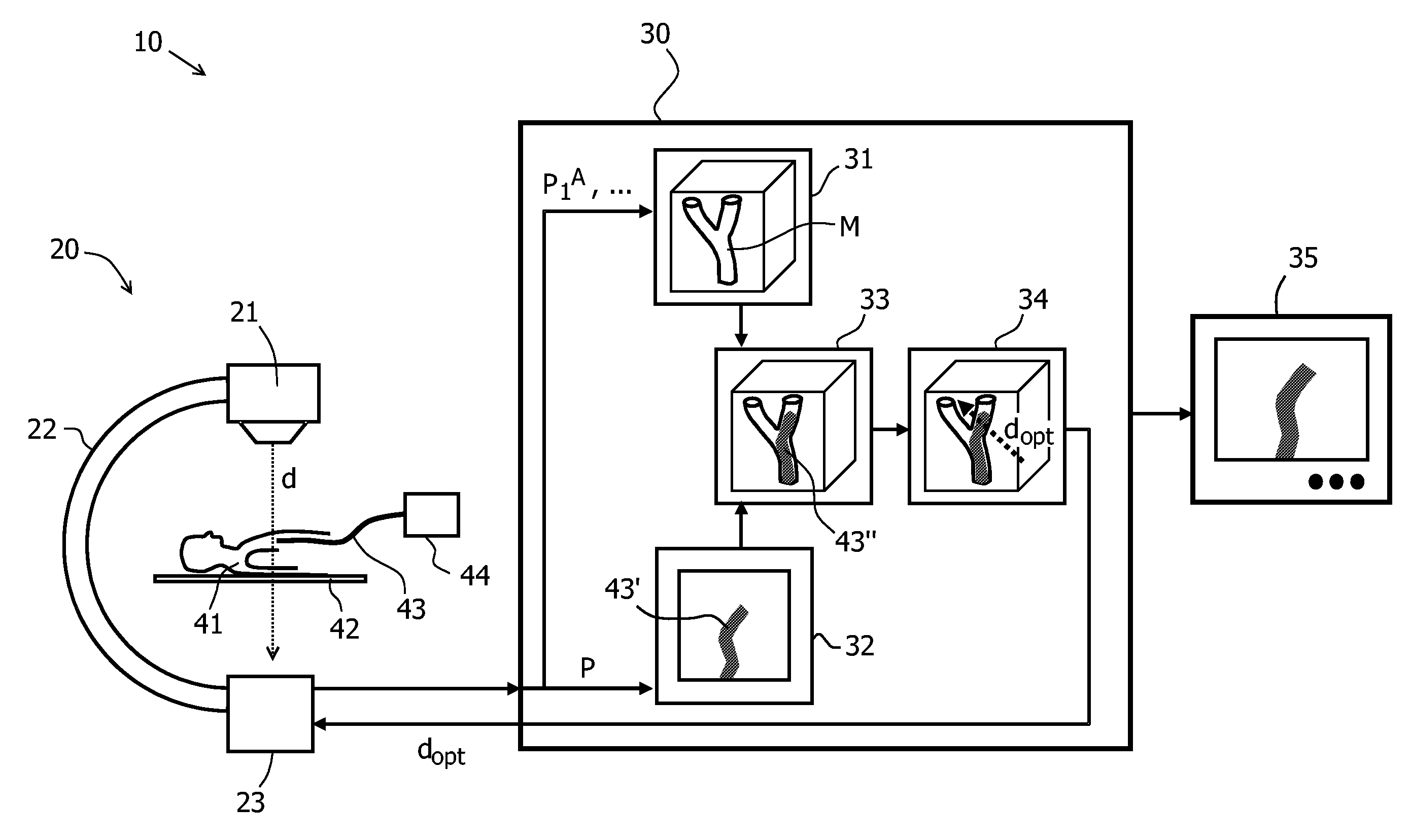 Method and apparatus for the observation of a catheter within a vessel system