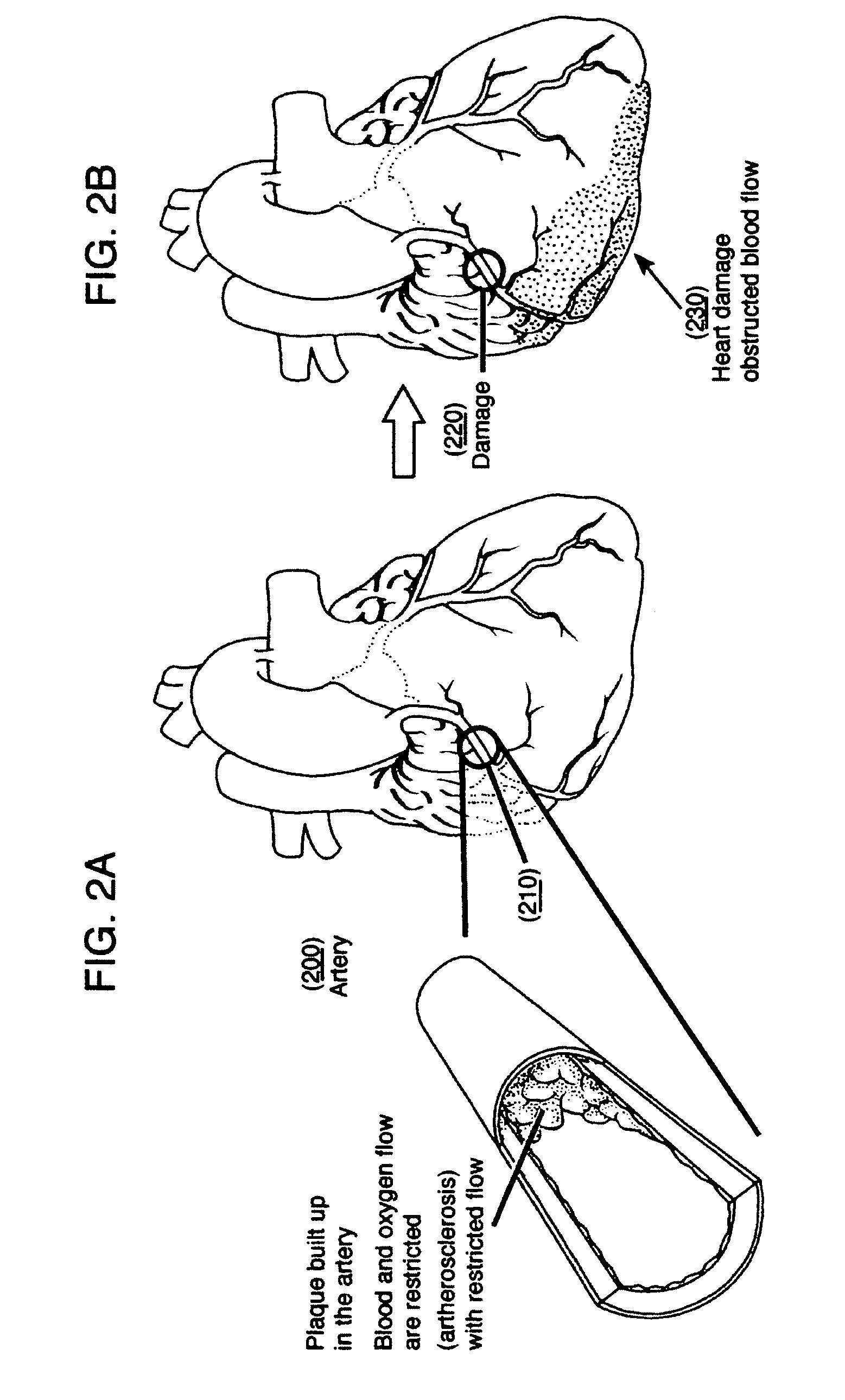 Methods and compositions to treat myocardial conditions