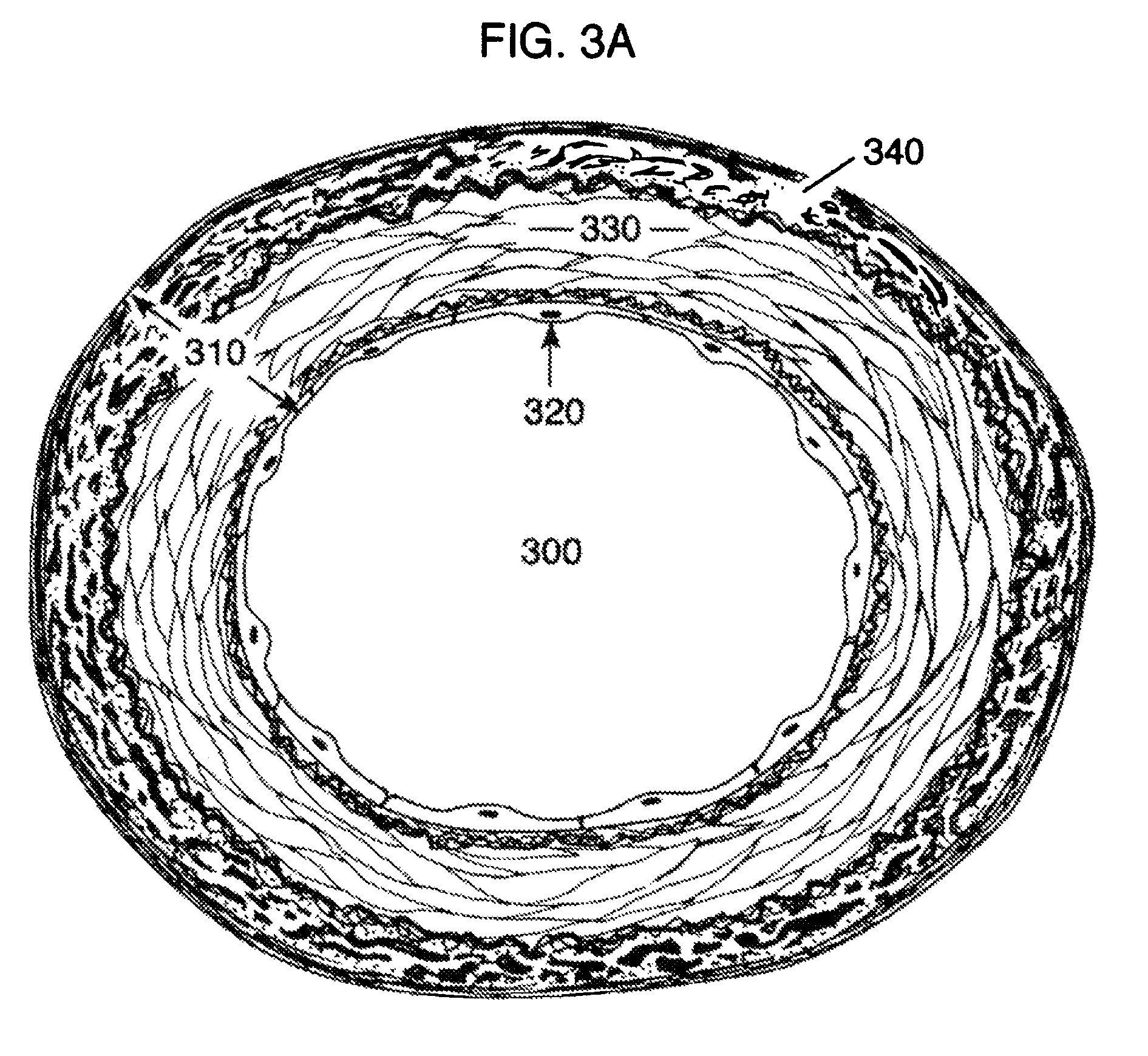 Methods and compositions to treat myocardial conditions