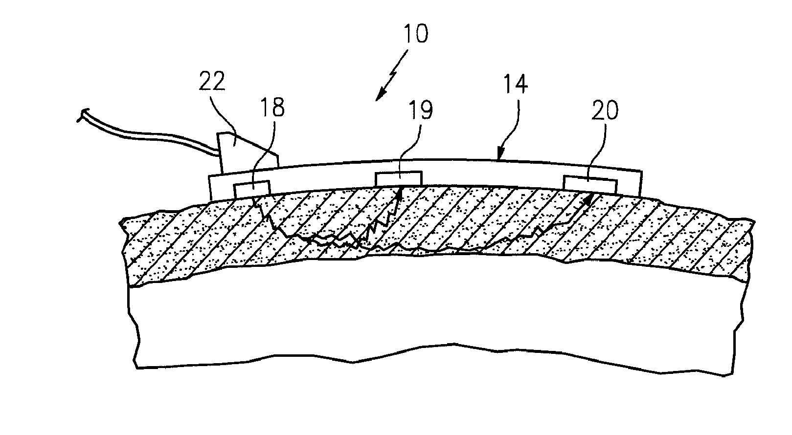 Method for spectrophotometric blood oxygenation monitoring of organs in the body