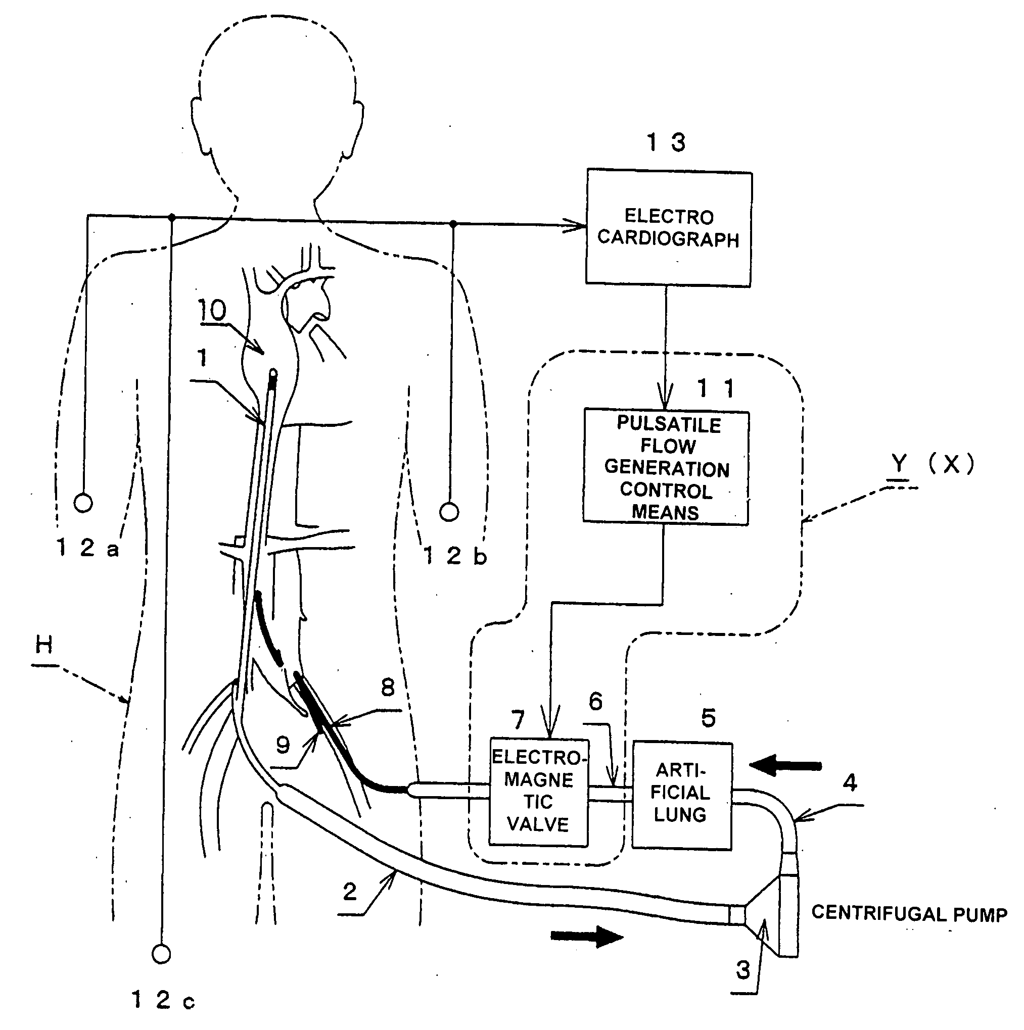 Pulsation-type auxiliary circulation system, pulsatile flow generation control device, and pulsatile flow generation control method