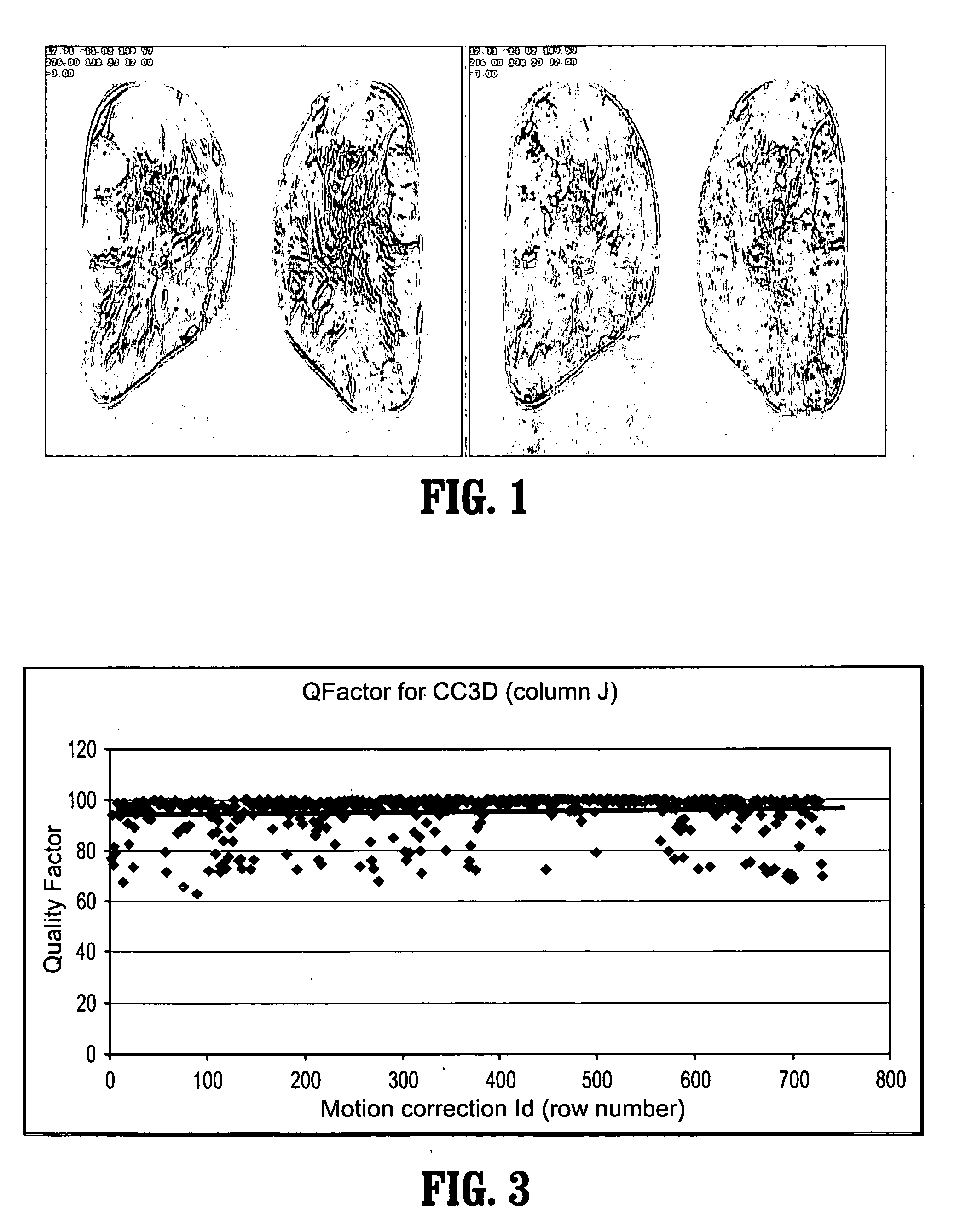 System and method for quantifying the quality of motion correction in image registration