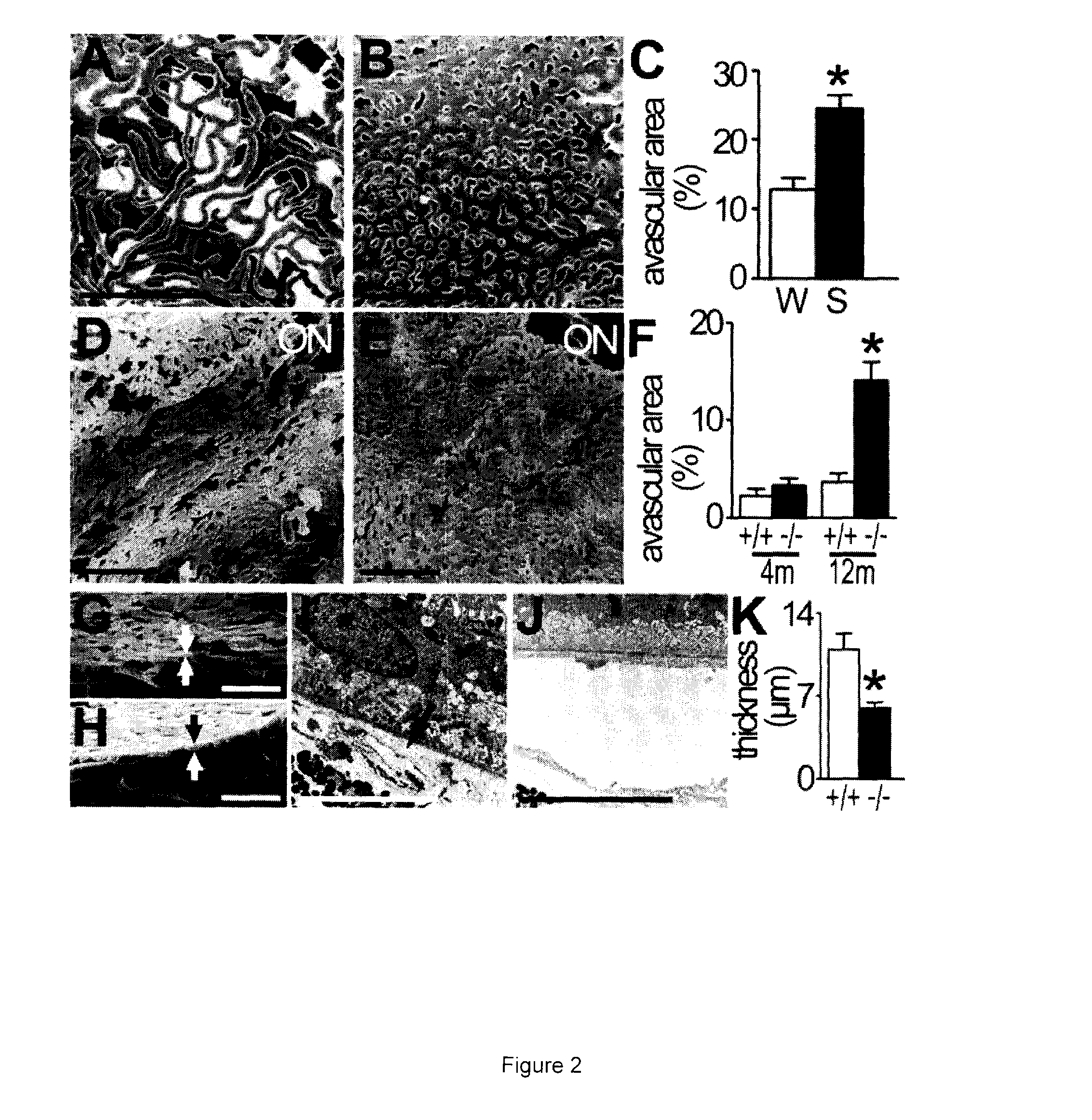 Treatment and prevention of dry age-related macular degeneration by activating CD36