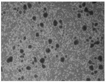 Method applicable to isolation and introduction of infiltrating T lymphocytes in malignant solid tumors