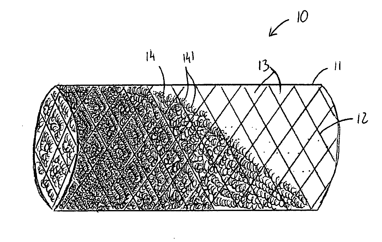 Intravascular device with netting system