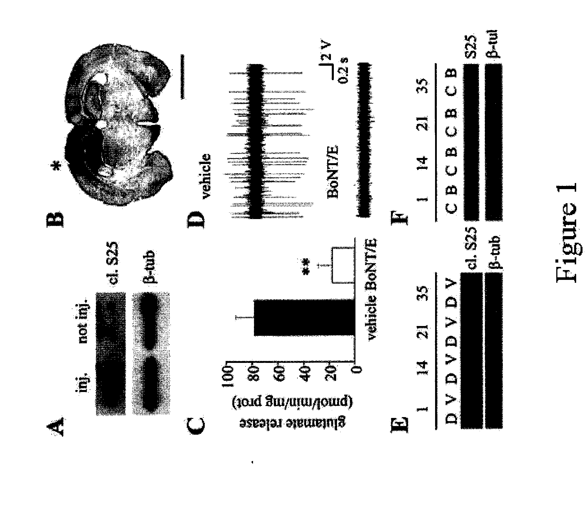 Method for the Mapping of the Epileptogenic Focus in the Pre-Surgical Evaluation of Patients with Intractable Epilepsy