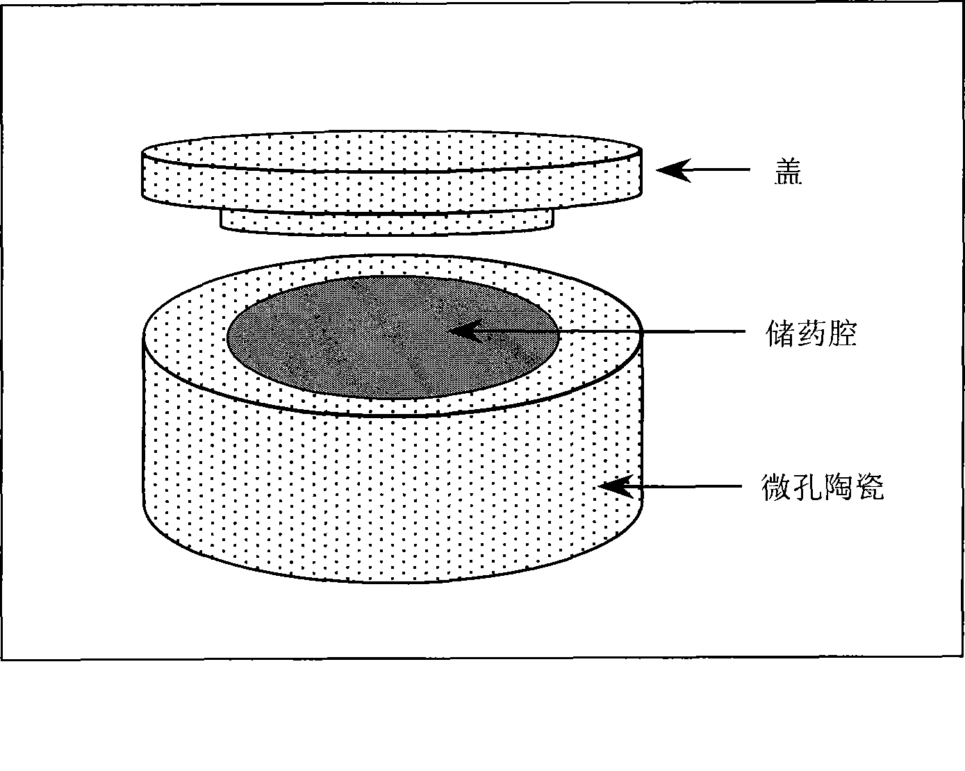 Micropore ceramics and method for sustained-release of medicament or biological preparation and use thereof