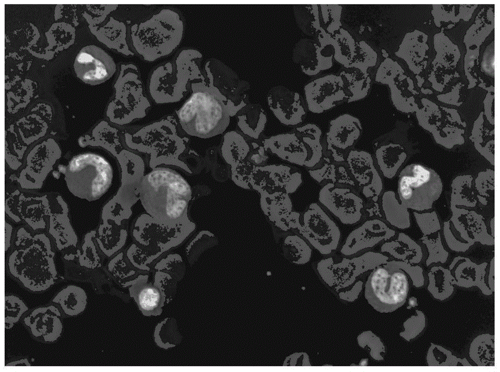 Method for partitioning cytoplasm and cell nucleuses of white blood cells in color blood cell image