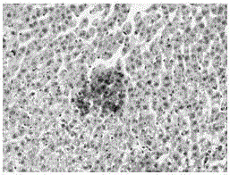 Medicine application of beta subunit of truncated type sodium-potassium atpase