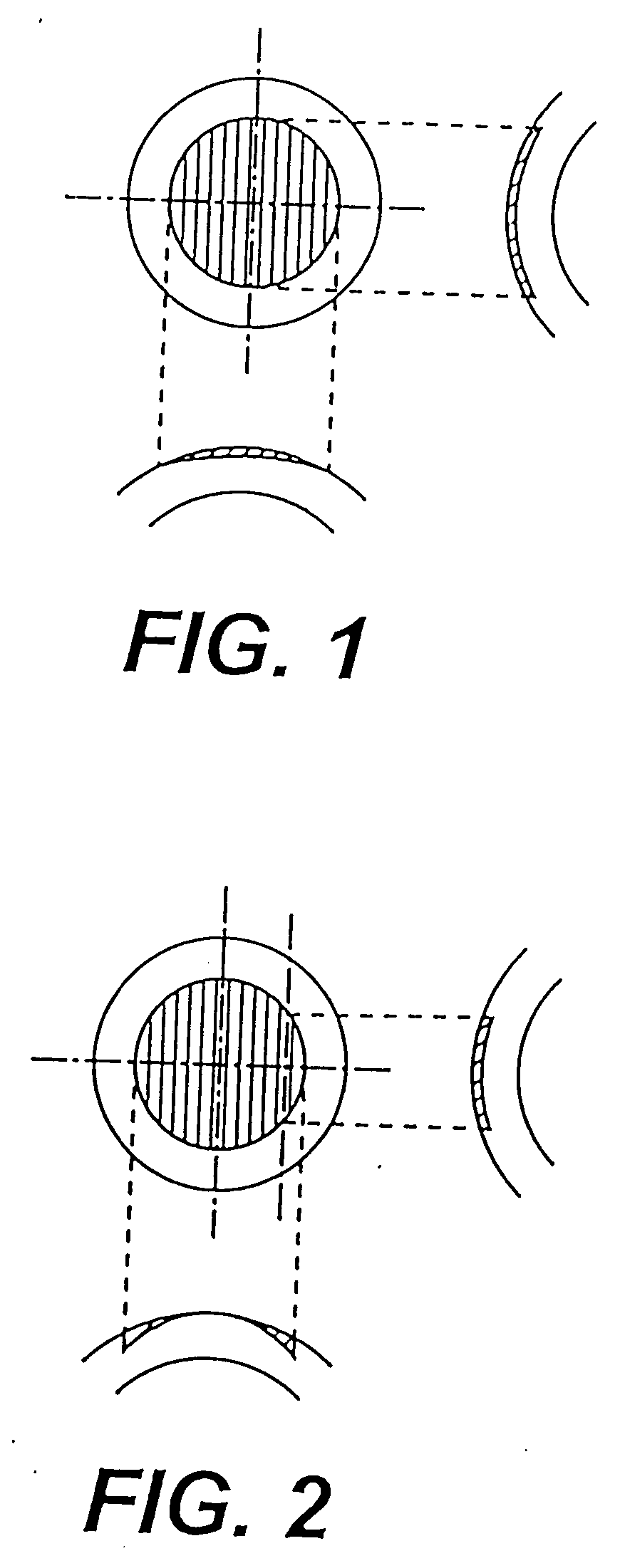 Apparatus for calculation of ablation data on a cornea for refractive correction and apparatus for operation on a cornea for refractive correction