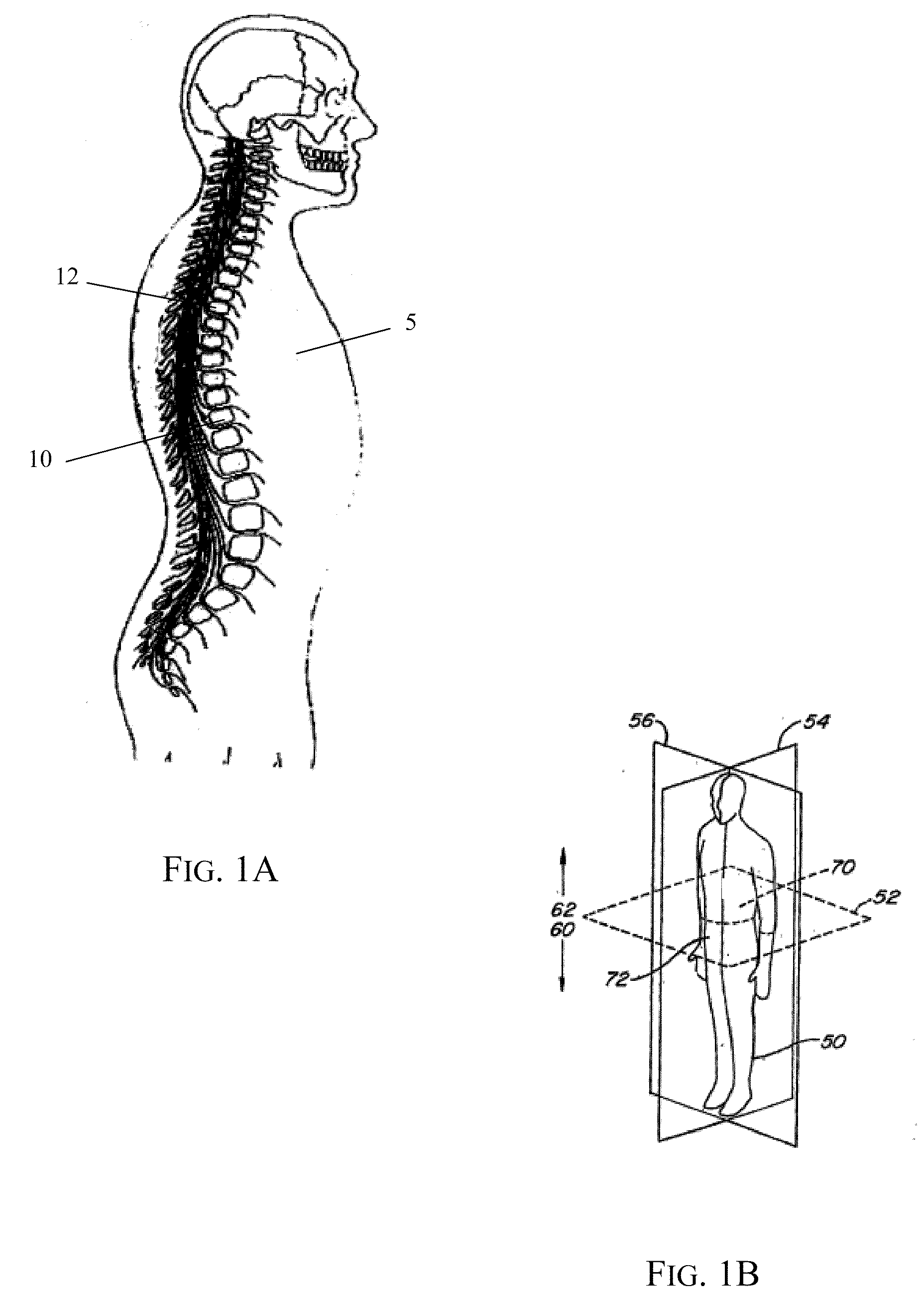 Implantable neural prosthetic device and methods of use