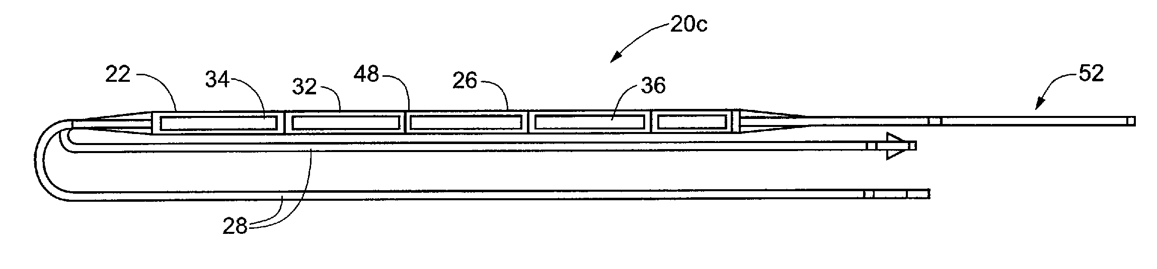 Intravascular implantable device having superior anchoring arrangement