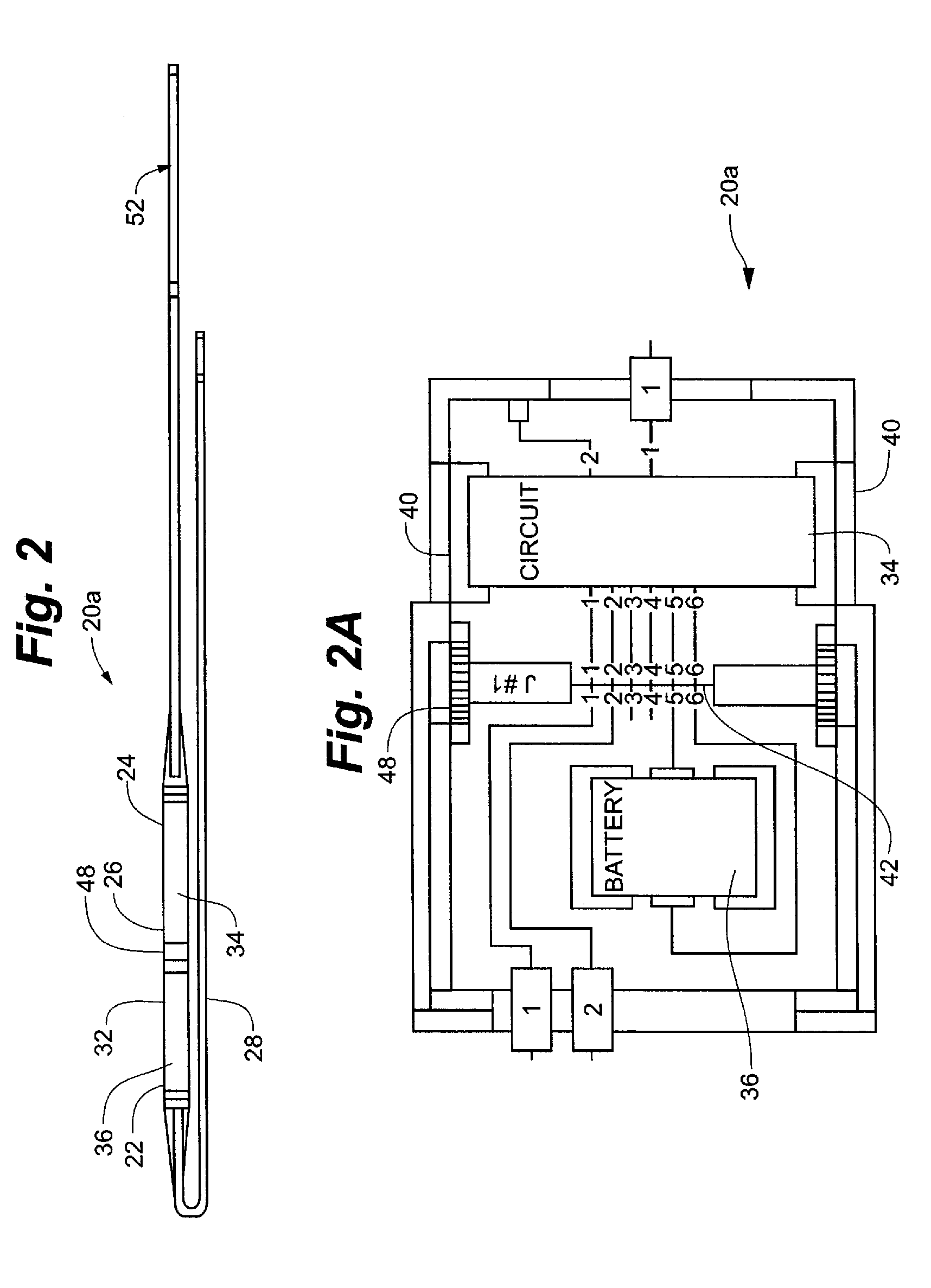 Intravascular implantable device having superior anchoring arrangement