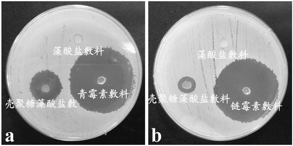 Chitosan alginate dressing and soaking preparation method thereof