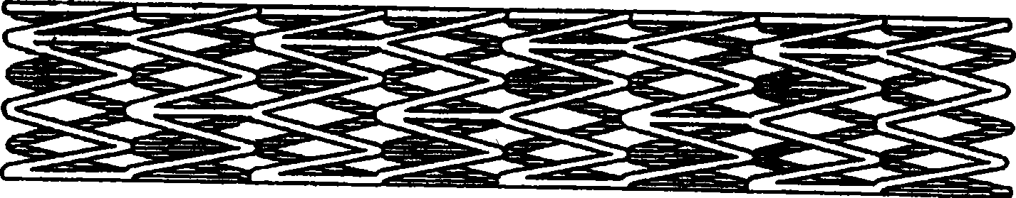 Method for preparing stent with coating in blood vessel