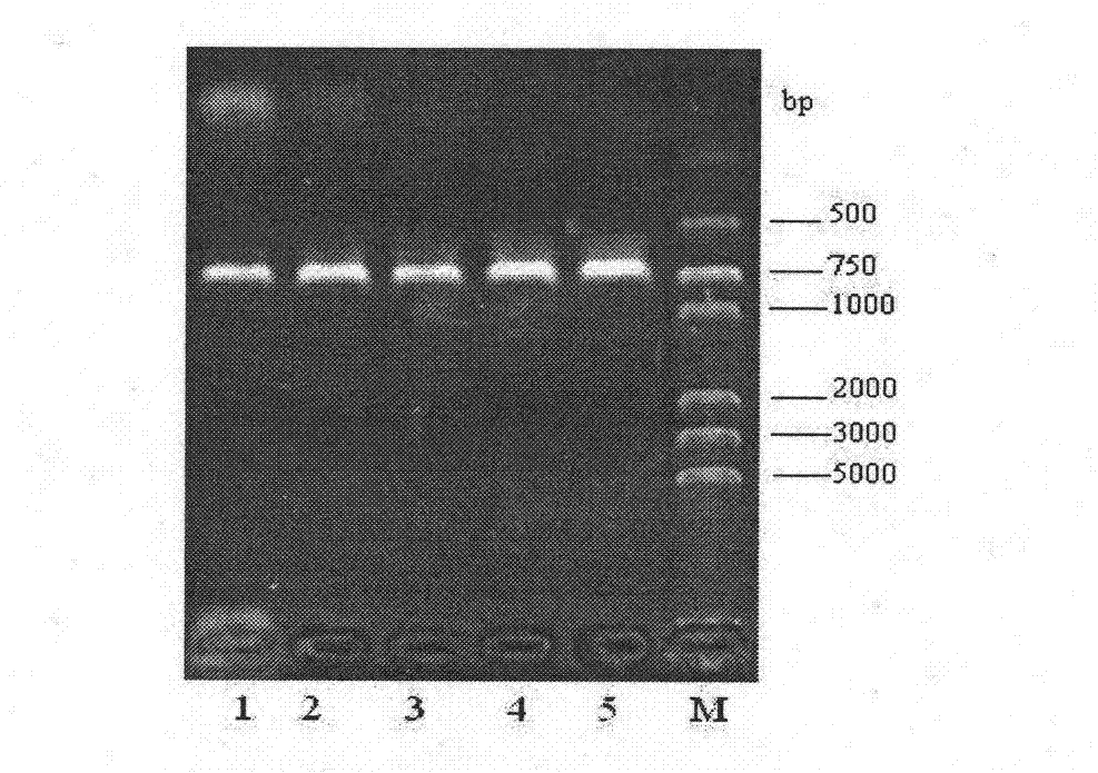 Swine Streptococcosis trivalent inactivated vaccine and preparation method thereof