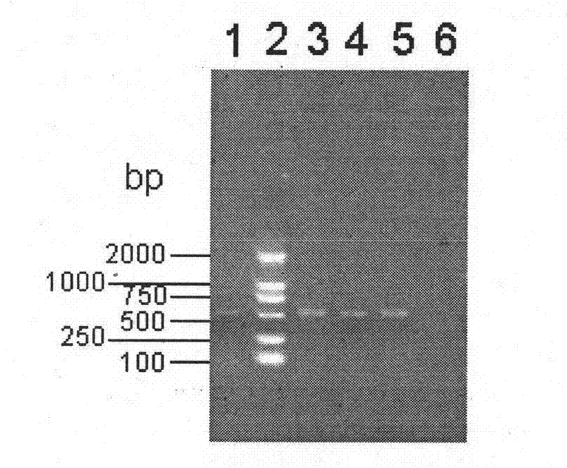 Swine Streptococcosis trivalent inactivated vaccine and preparation method thereof