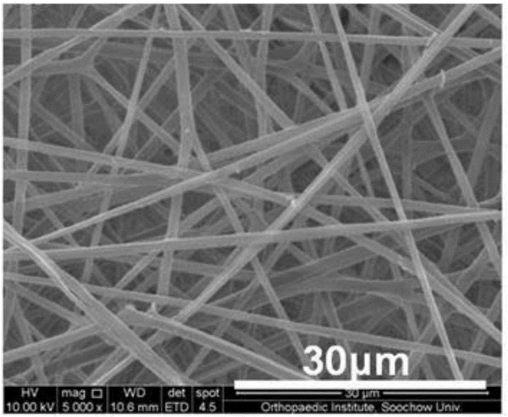 Degradable biliary duct drug-eluting stent