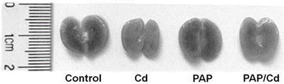 Application of potentilla anserine polysaccharides to preparing medicines for treating renal injury