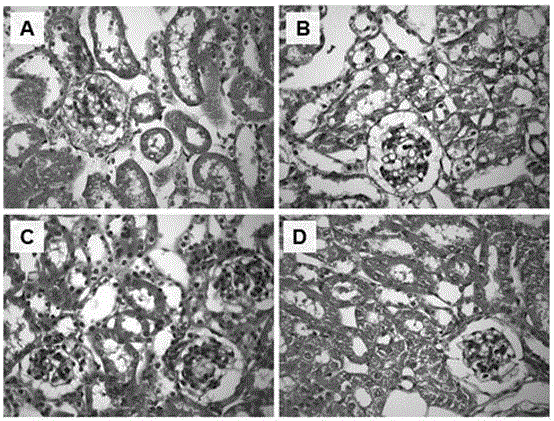 Application of potentilla anserine polysaccharides to preparing medicines for treating renal injury