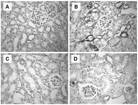 Application of potentilla anserine polysaccharides to preparing medicines for treating renal injury