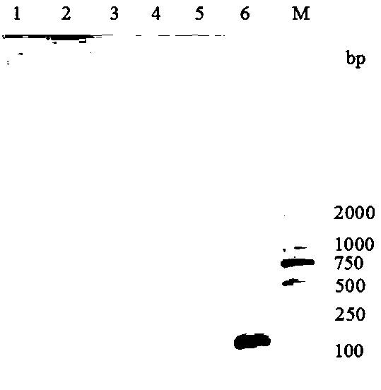 Primers for real-time fluorescent quantitative PCR (polymerase chain reaction) assay of novel pigeon adenovirus EvaGreen