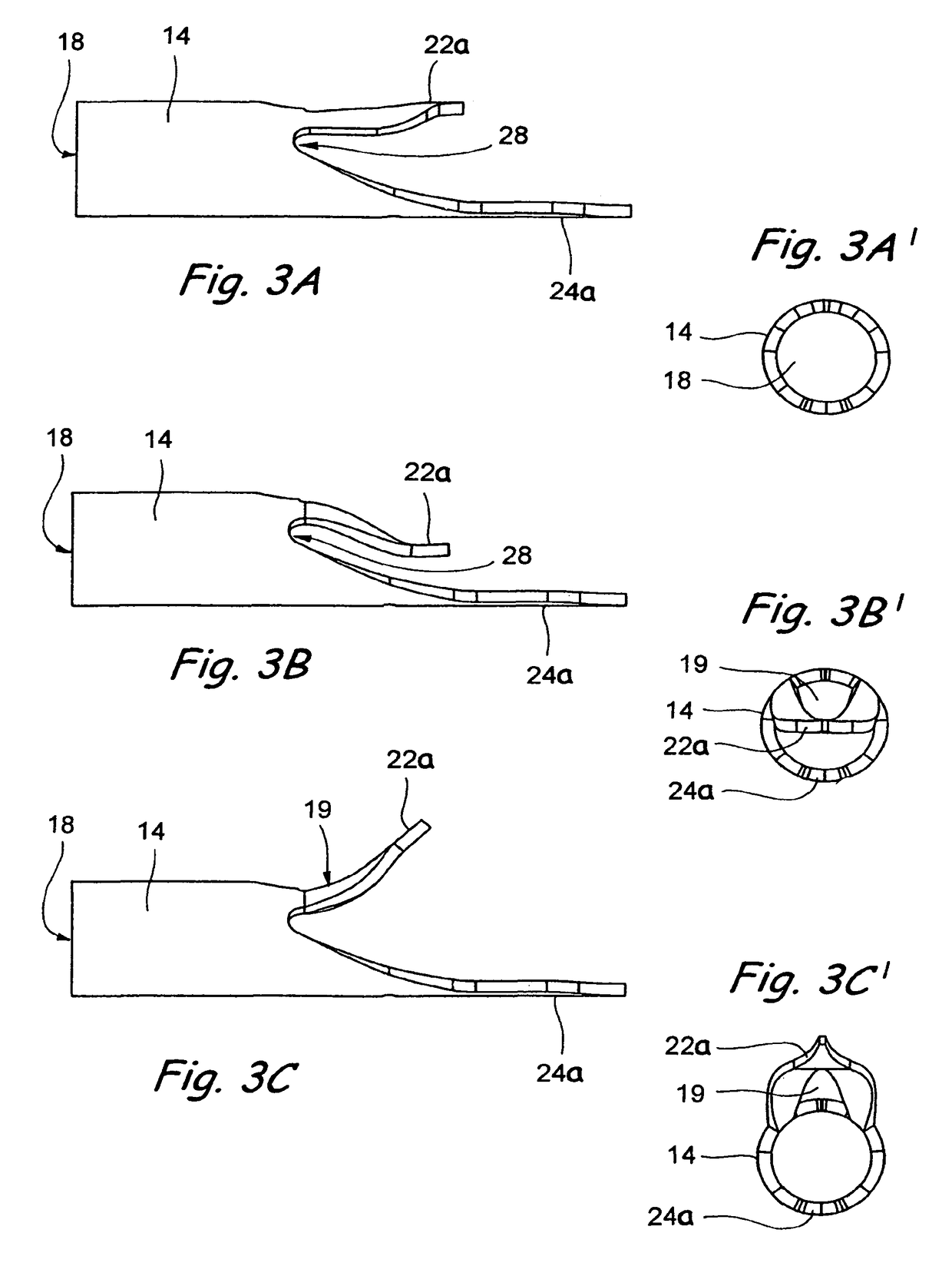 Devices useable for treatment of glaucoma and other surgical procedures