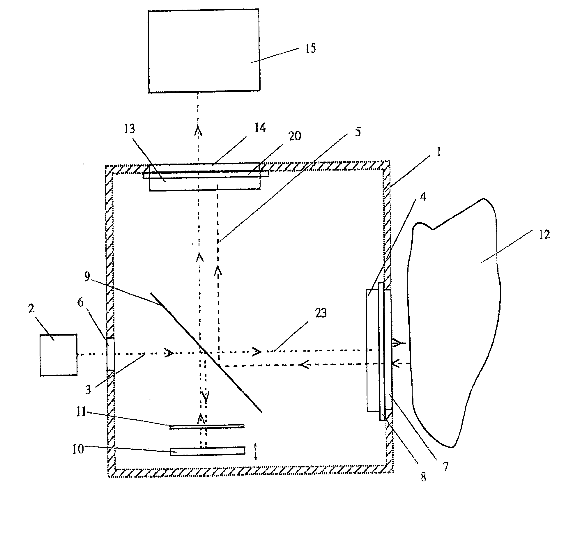 Diagnostic apparatus using terahertz radiation