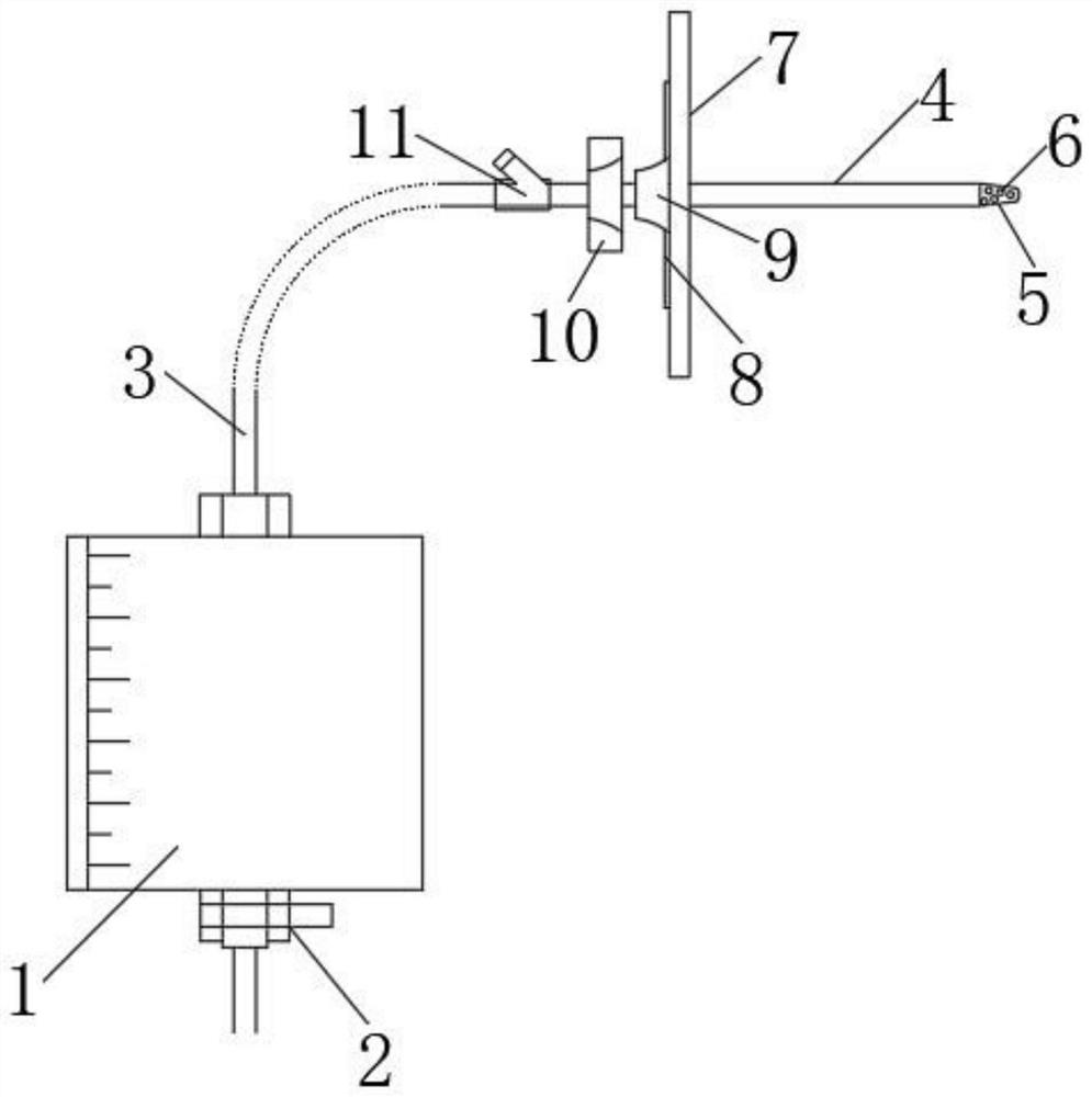 Novel abdominal cavity cathetering drainage assembly