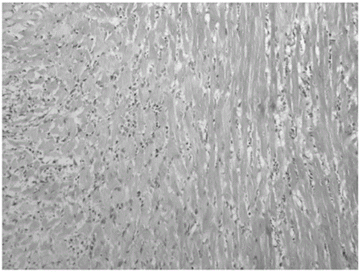 Uses of myocarditis protein marker