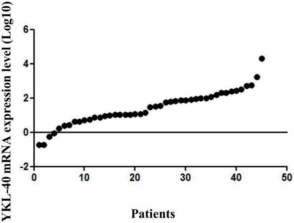 Application of YKL-40 as glioblastoma biomarker