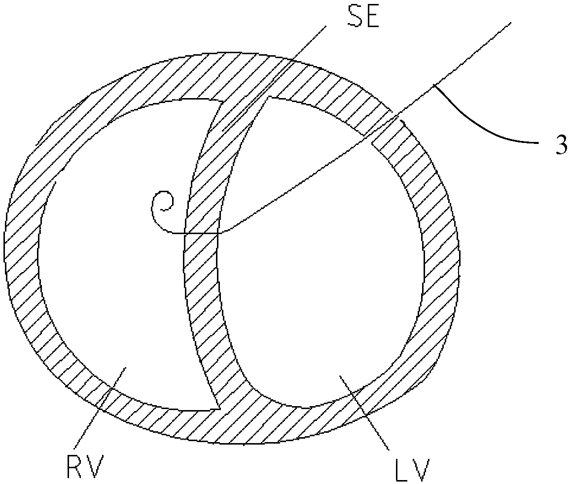 Medical device