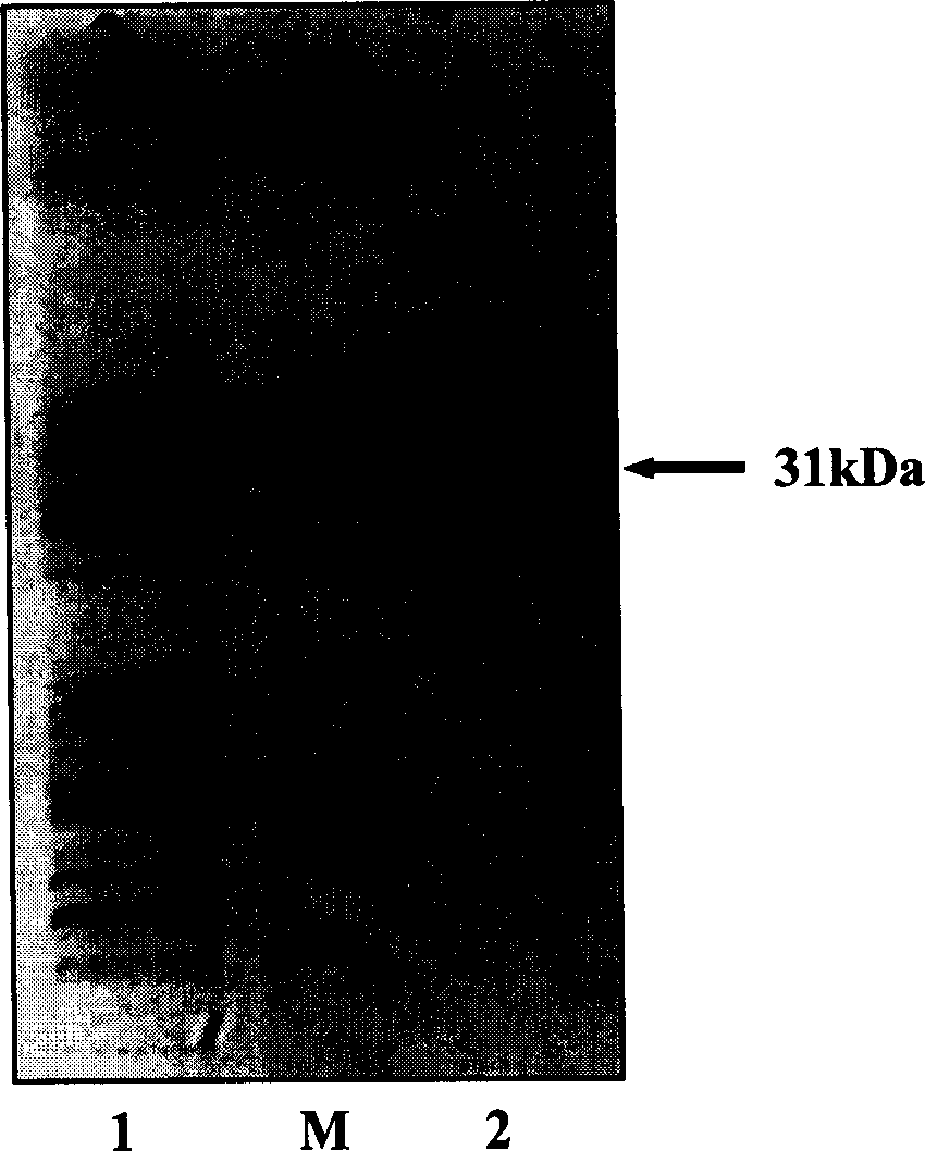 Antibody for treating or preventing senile dementia, its expression vector and application in drug preparation