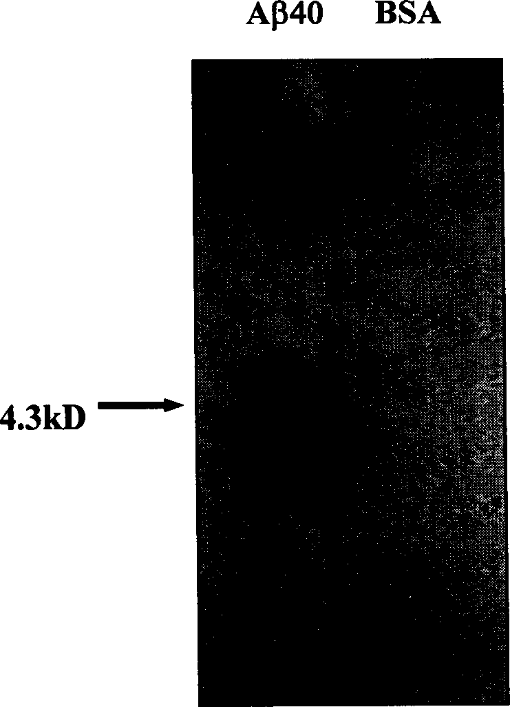 Antibody for treating or preventing senile dementia, its expression vector and application in drug preparation