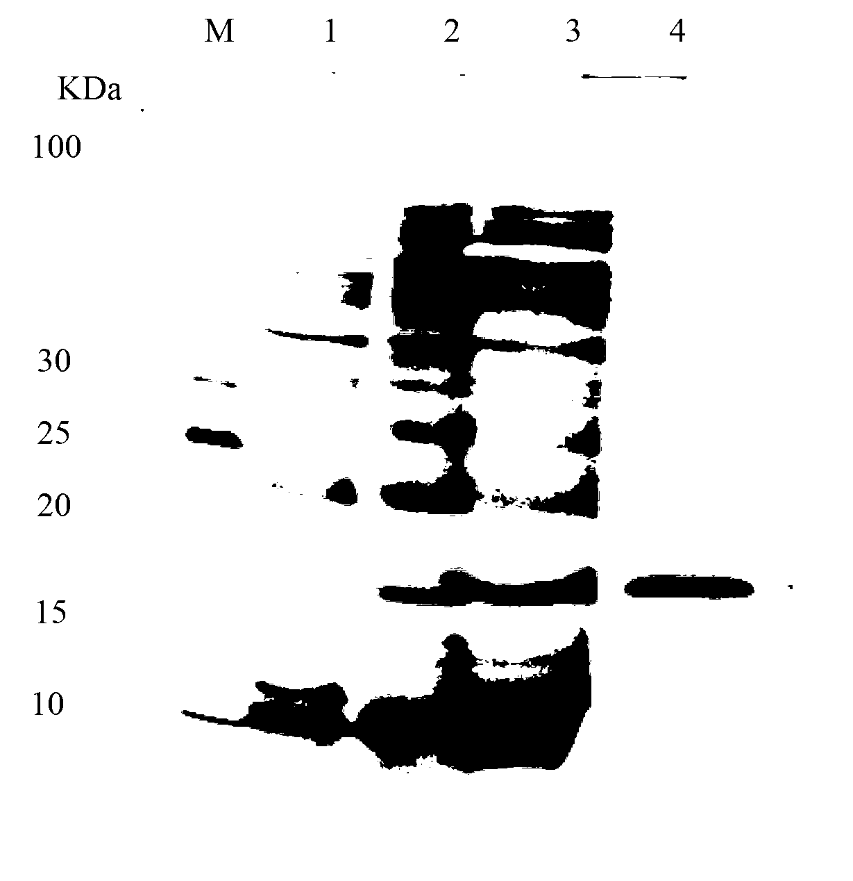 Secretory expression method of bacteriocin lacticin Q