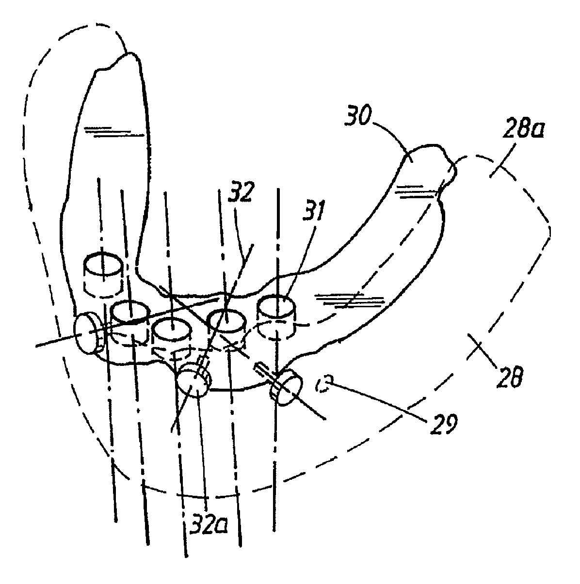 Arrangement and device for using a template to form holes for implants in bone, preferably jaw bone