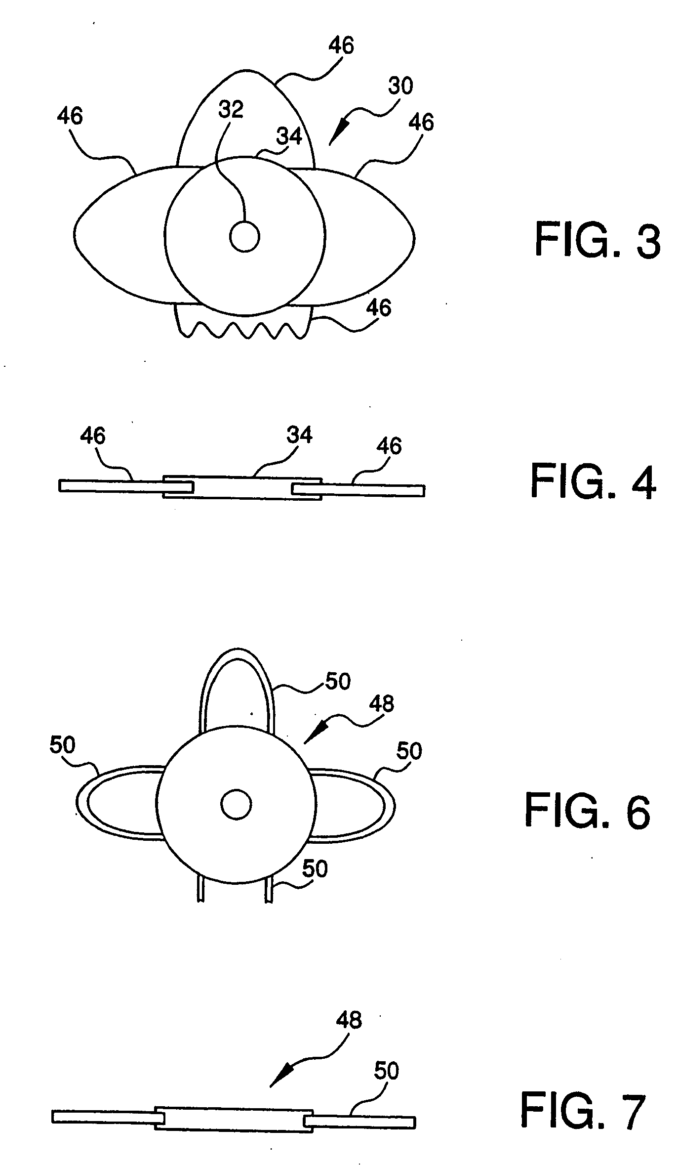 Bifocal intraocular telescope for low vision correction