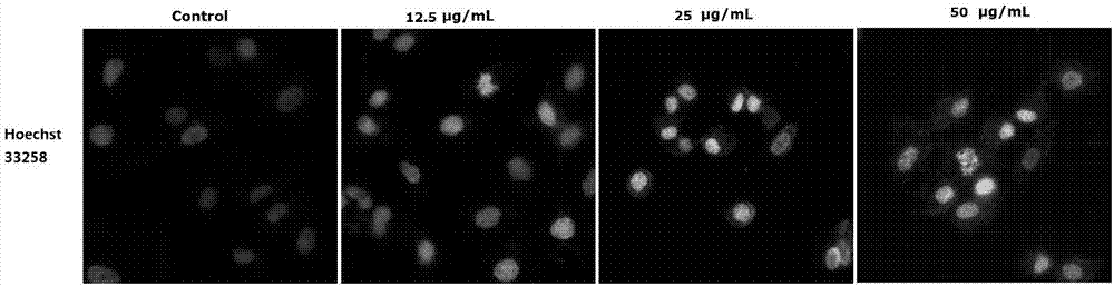 Application of fluoro-thiosemicarbazone compound in antitumor drug