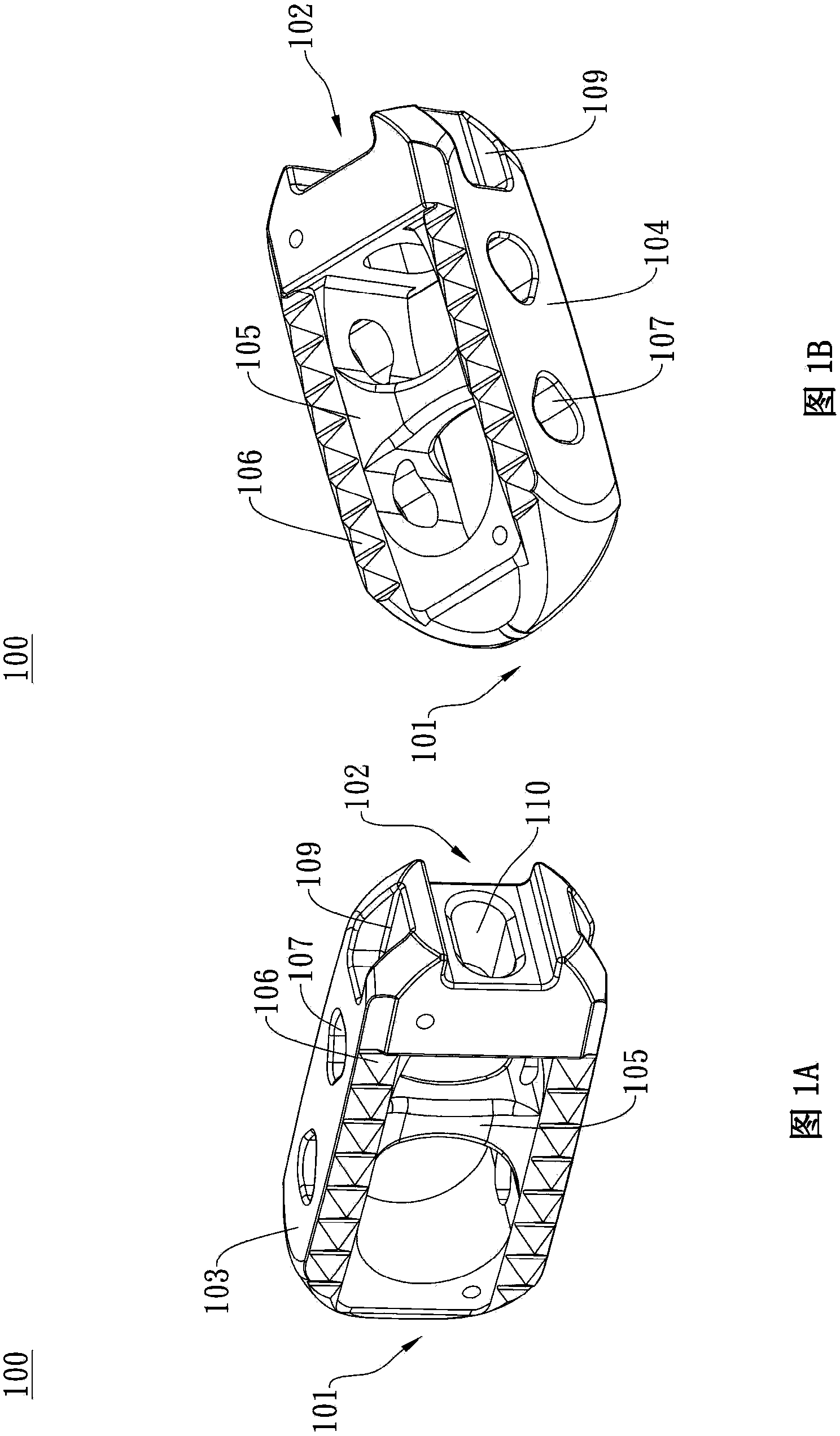 Spinal implant structure body and suites thereof