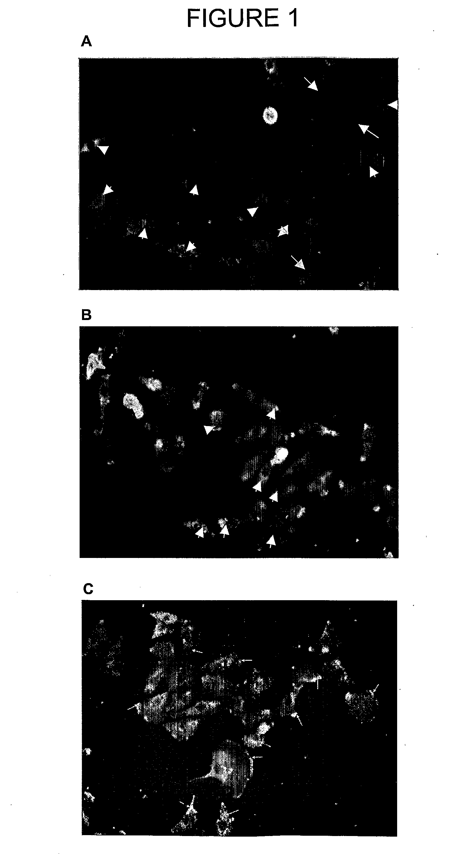 Inhibitors of protein kinase c isoforms and uses thereof