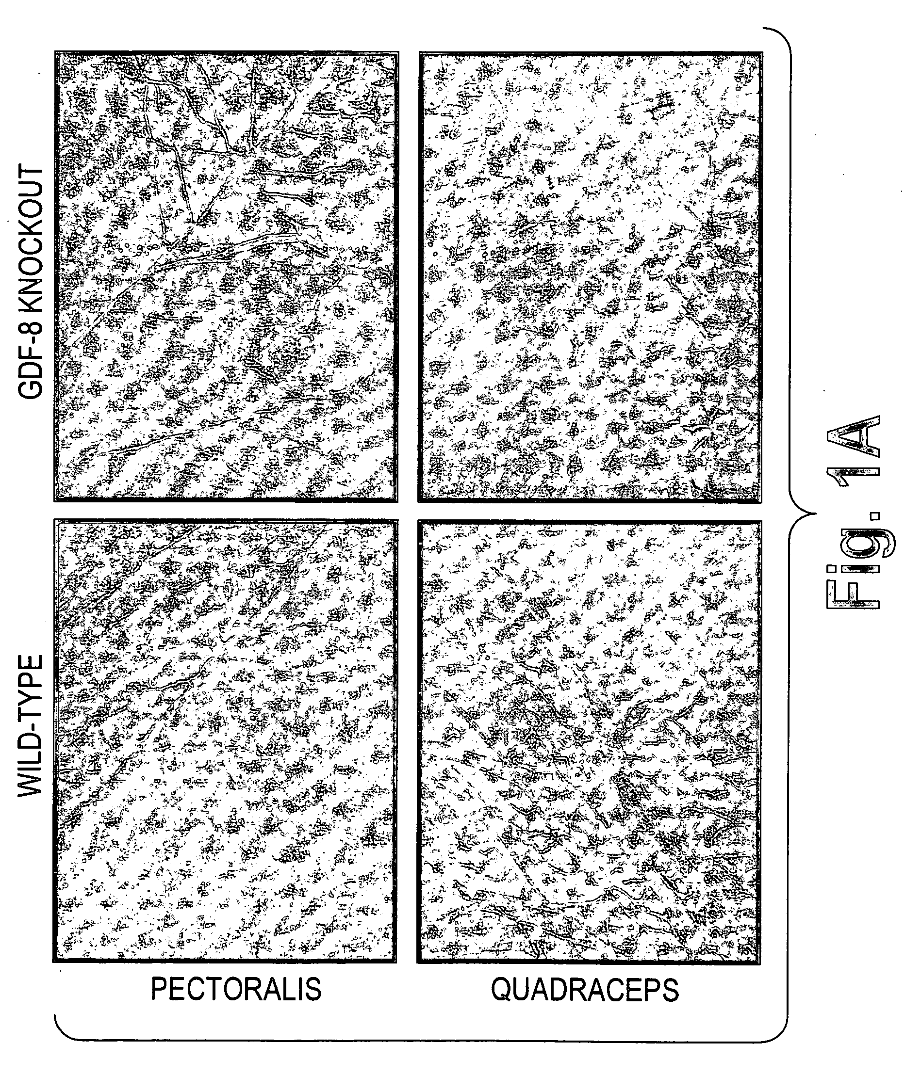 Methods for treating diabetes