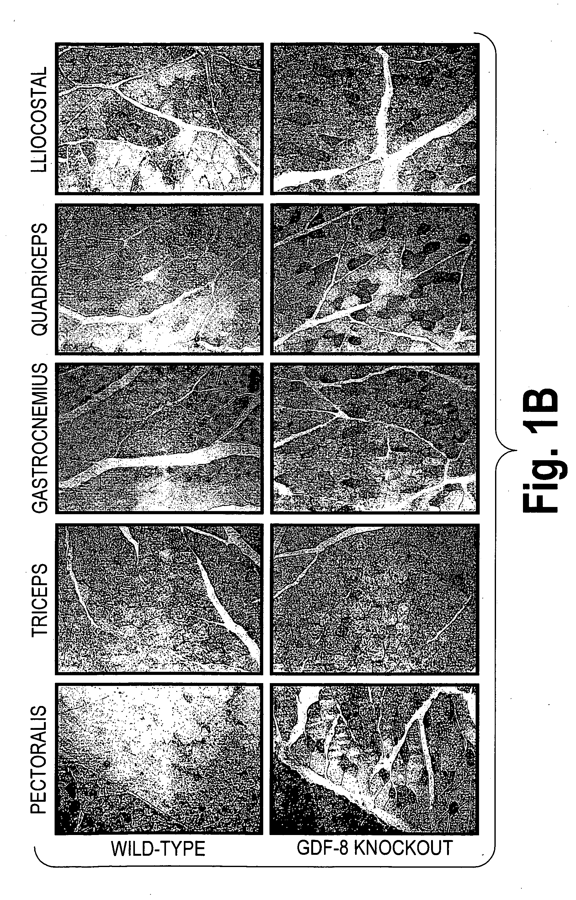 Methods for treating diabetes